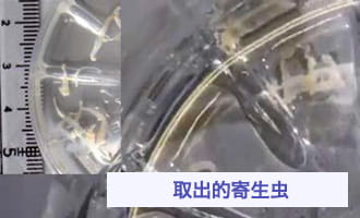 取出的寄生虫